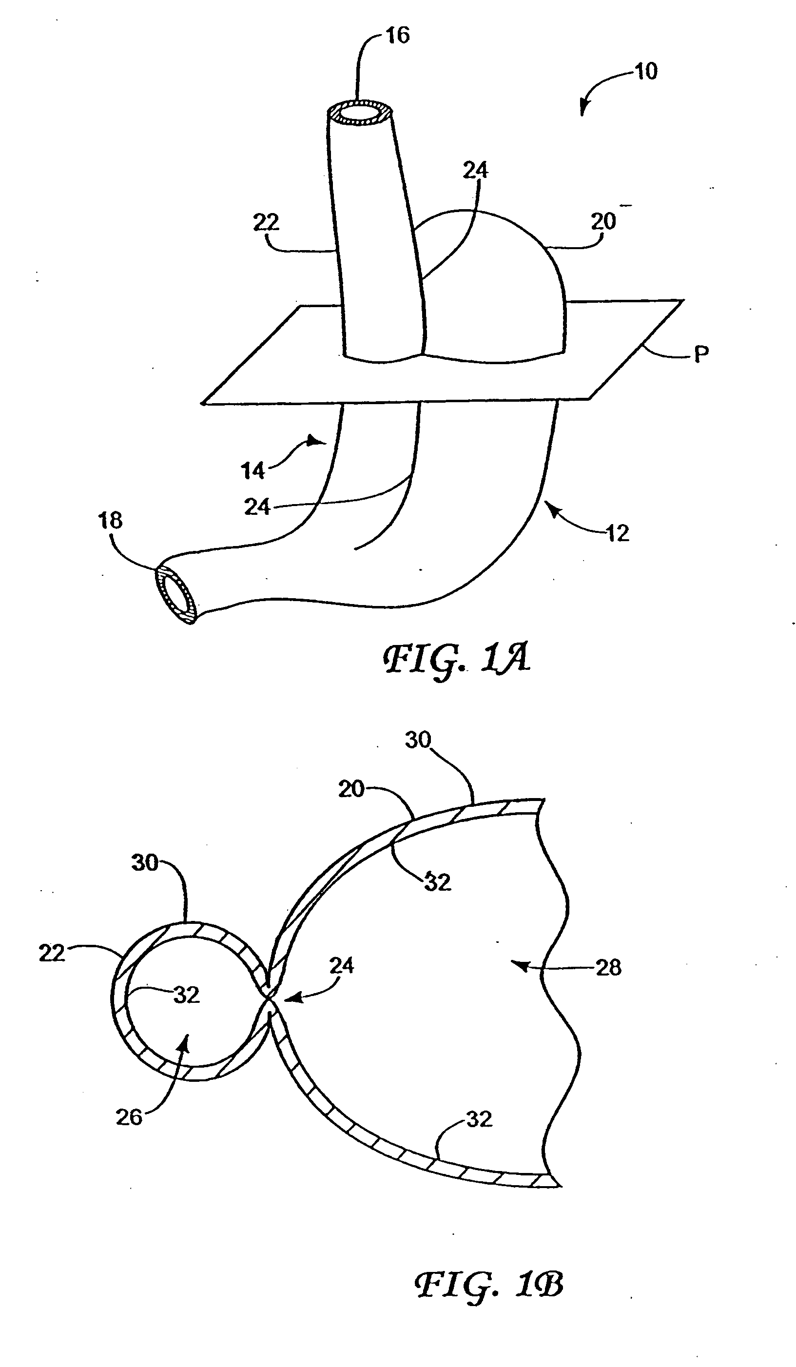 Obesity treatment tools and methods