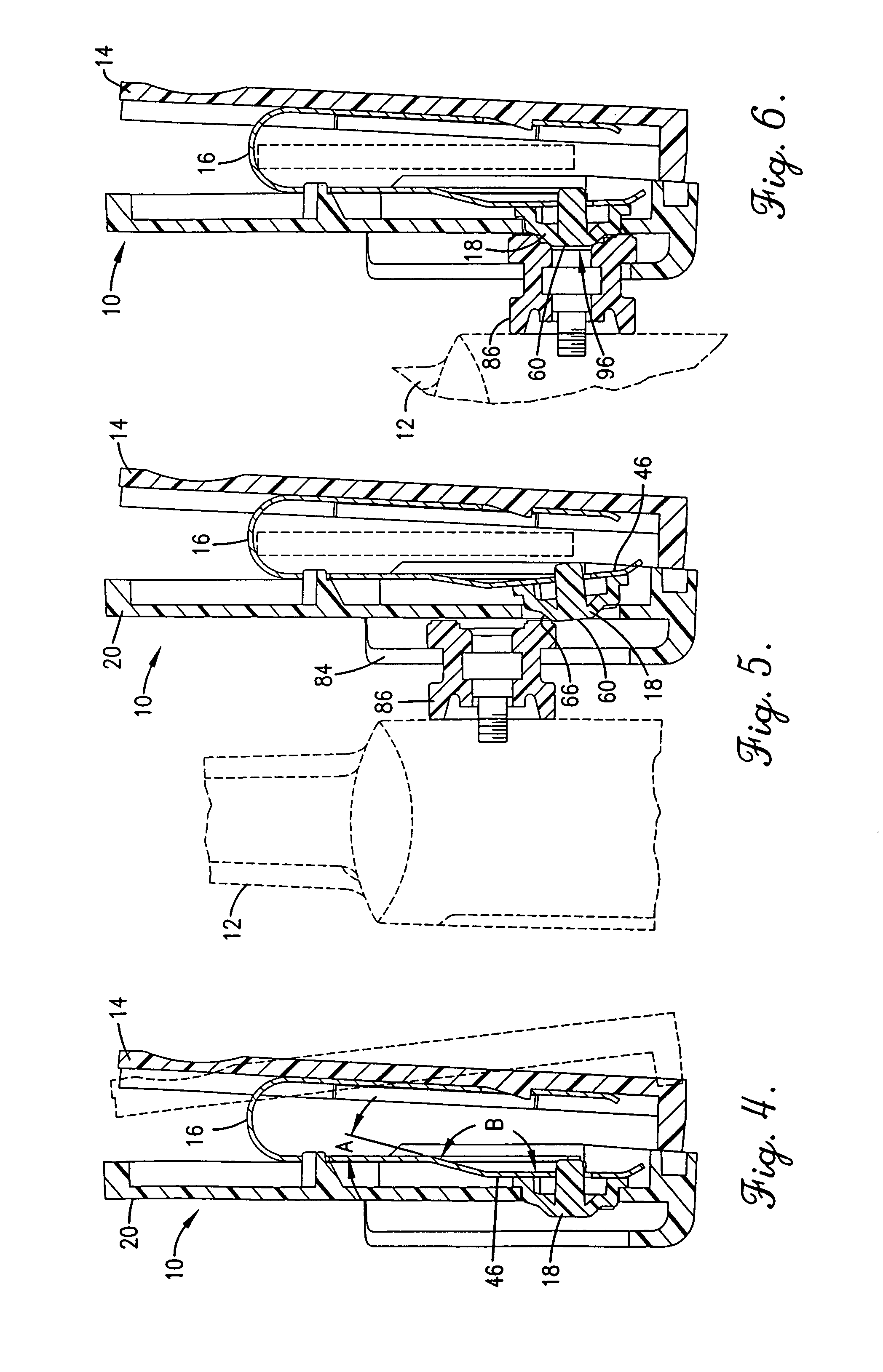 Carrying assembly and method for securement of electronic devices
