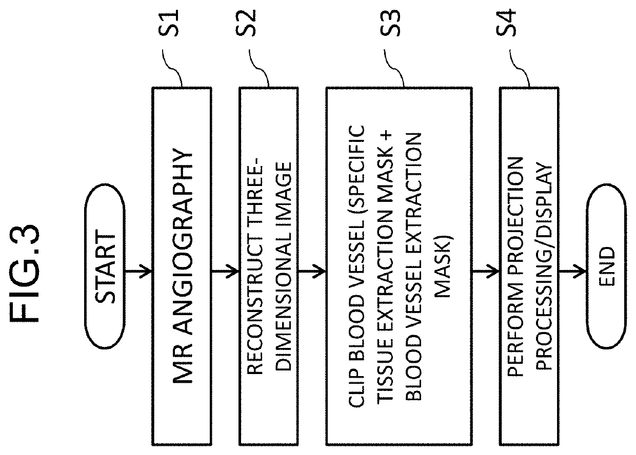 Magnetic resonance imaging apparatus, image processor, and image processing method