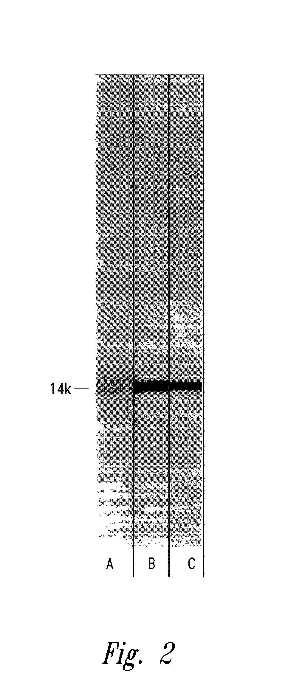 Antigen of hybrid M protein and carrier for group A streptococcal vaccine