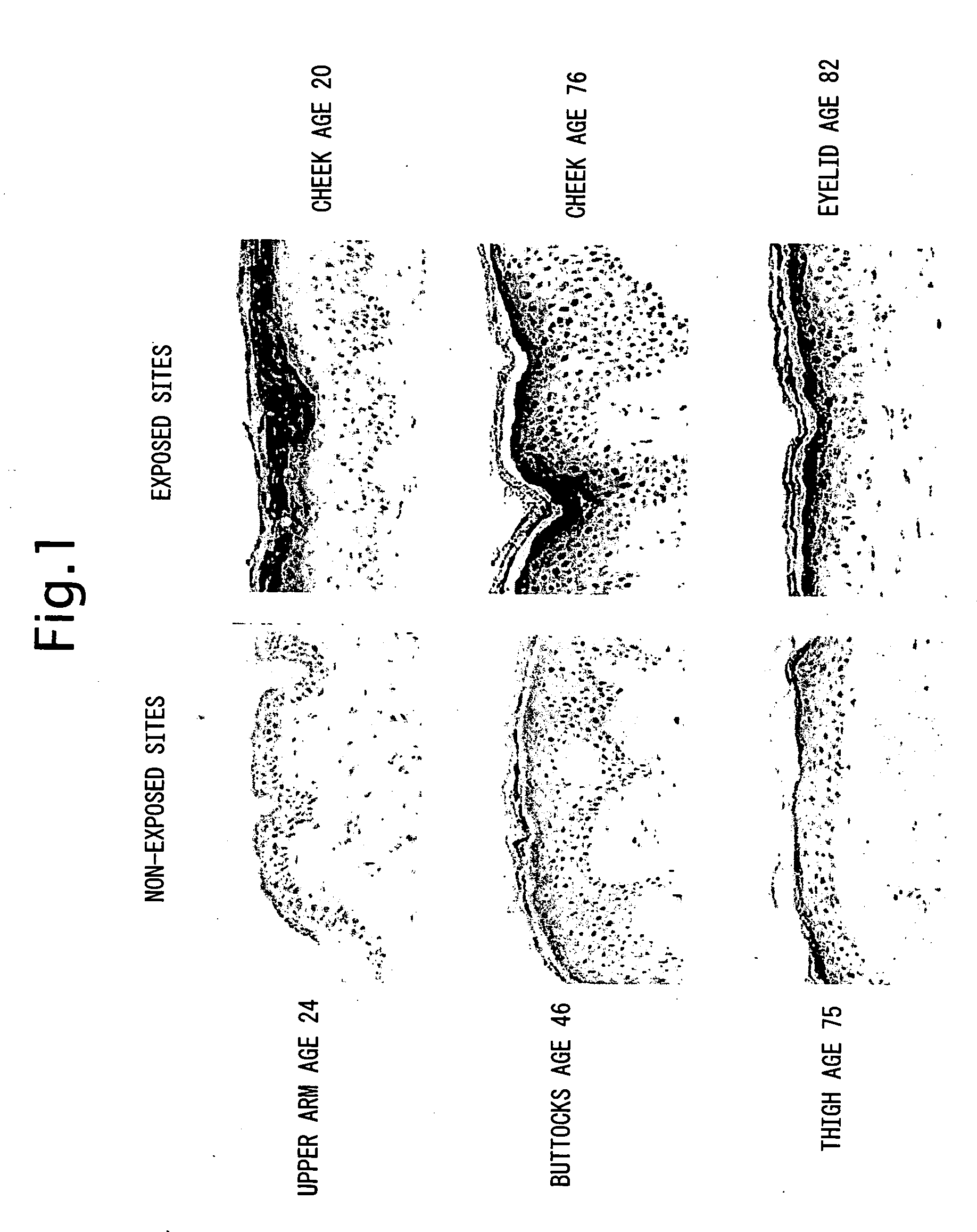 Method for reducing ultraviolet light induced apoptosis