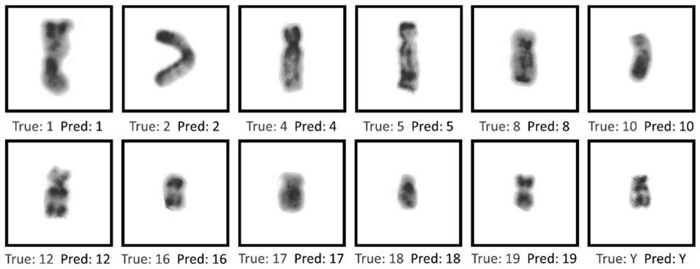 R-band chromosome karyotype image identification method and system based on grouping information assistance
