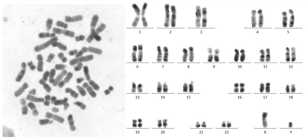 R-band chromosome karyotype image identification method and system based on grouping information assistance