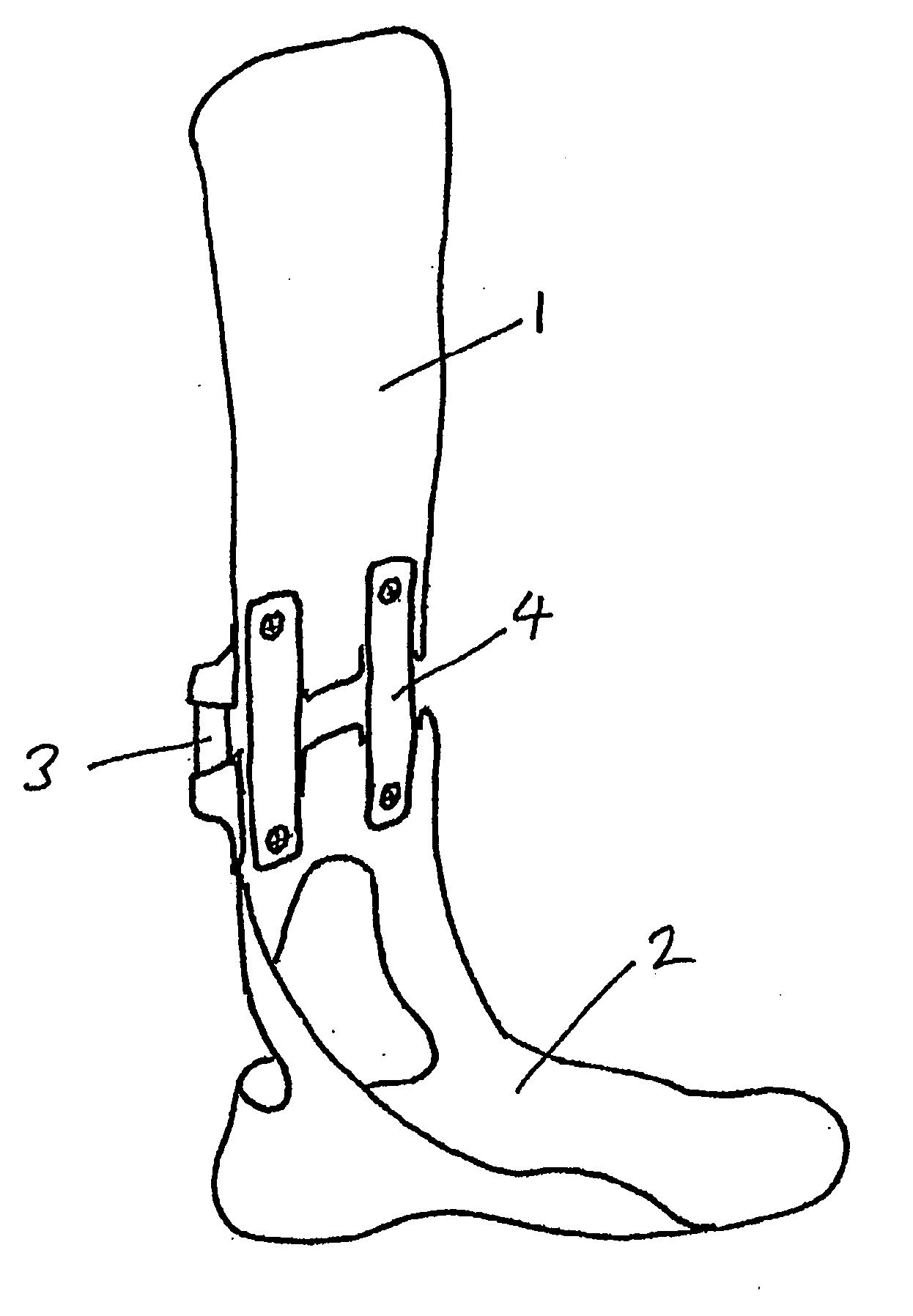 Articulated Orthosis Providing Lift Support