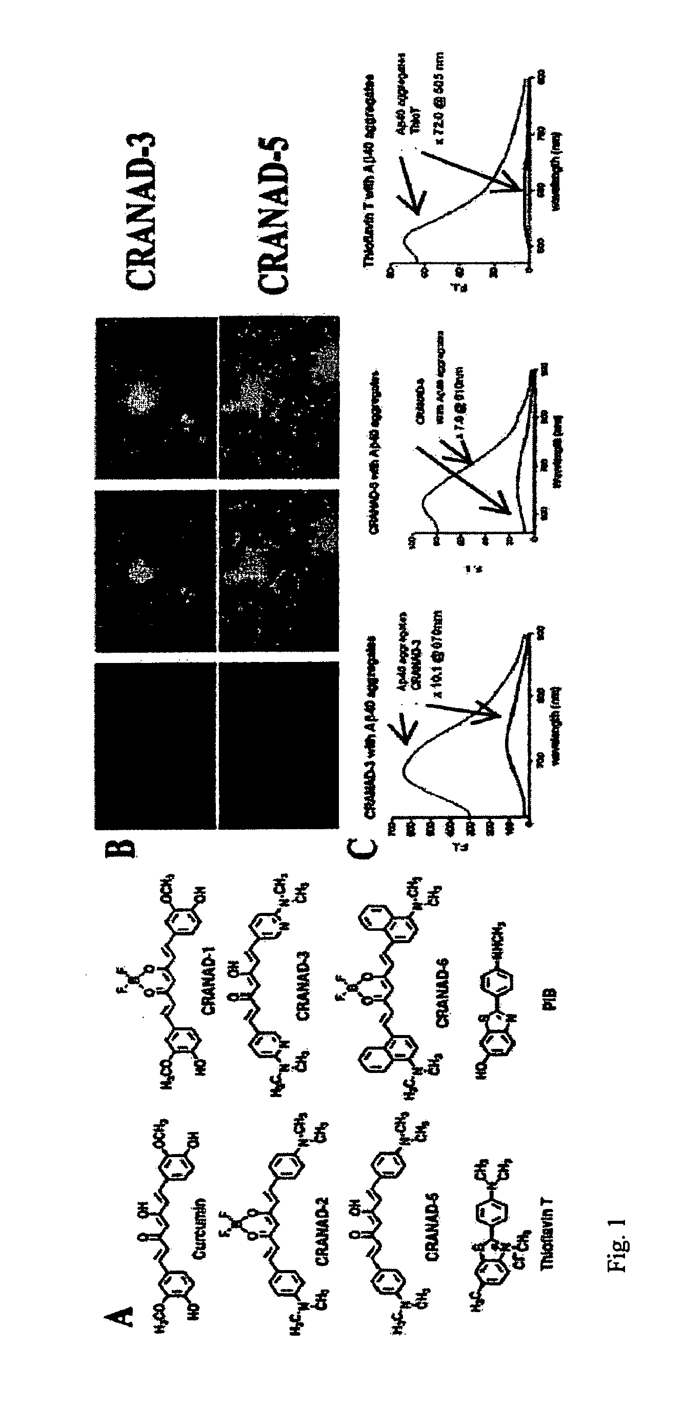 Methods and System for Detecting Soluble Amyloid-Beta