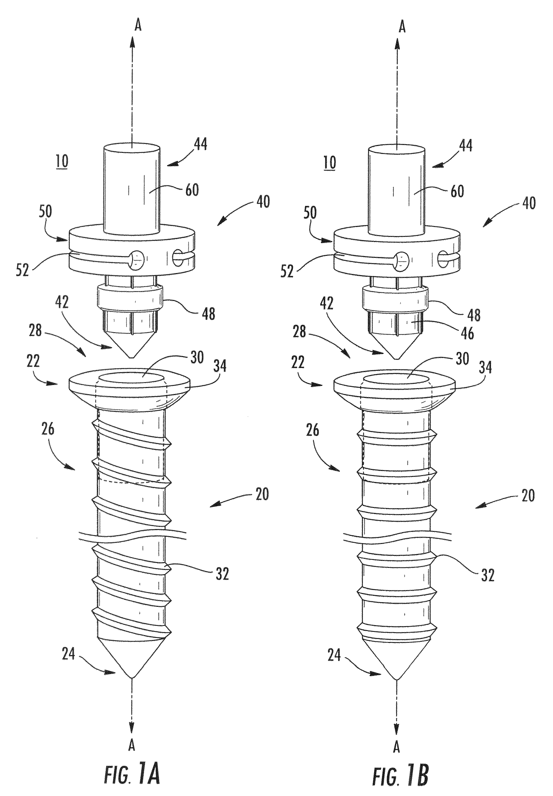 Soft tissue fixation assembly and method