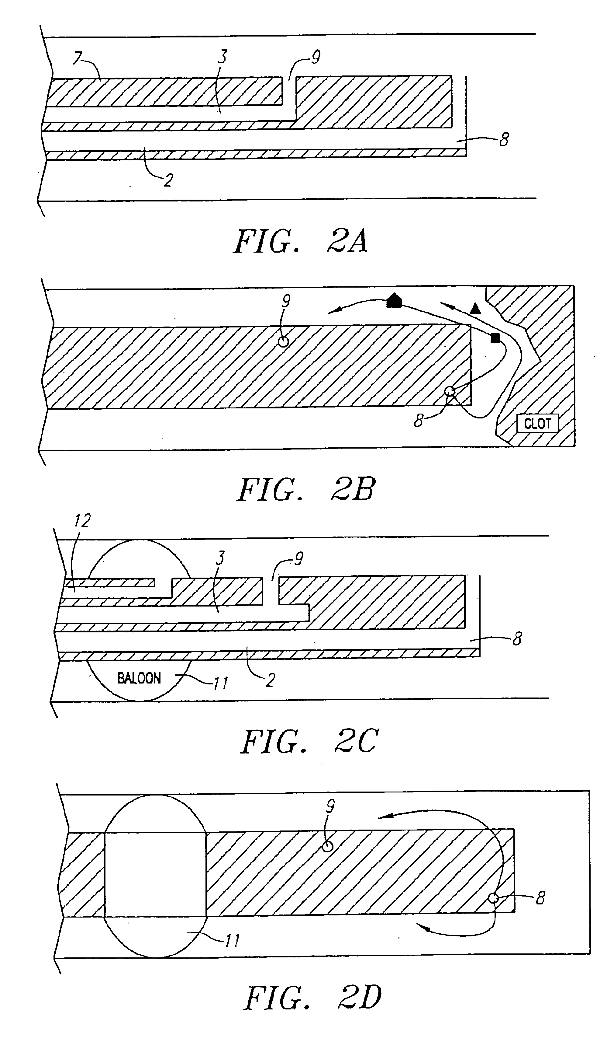 Fluid exchange system for controlled and localized irrigation and aspiration