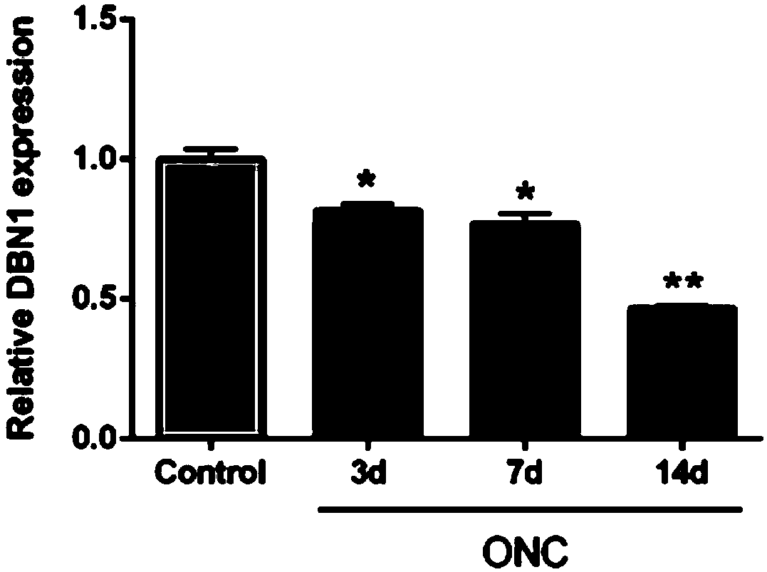 Application of drebrin (DBN1) to preparing neurodegenerative disease diagnosis medicines