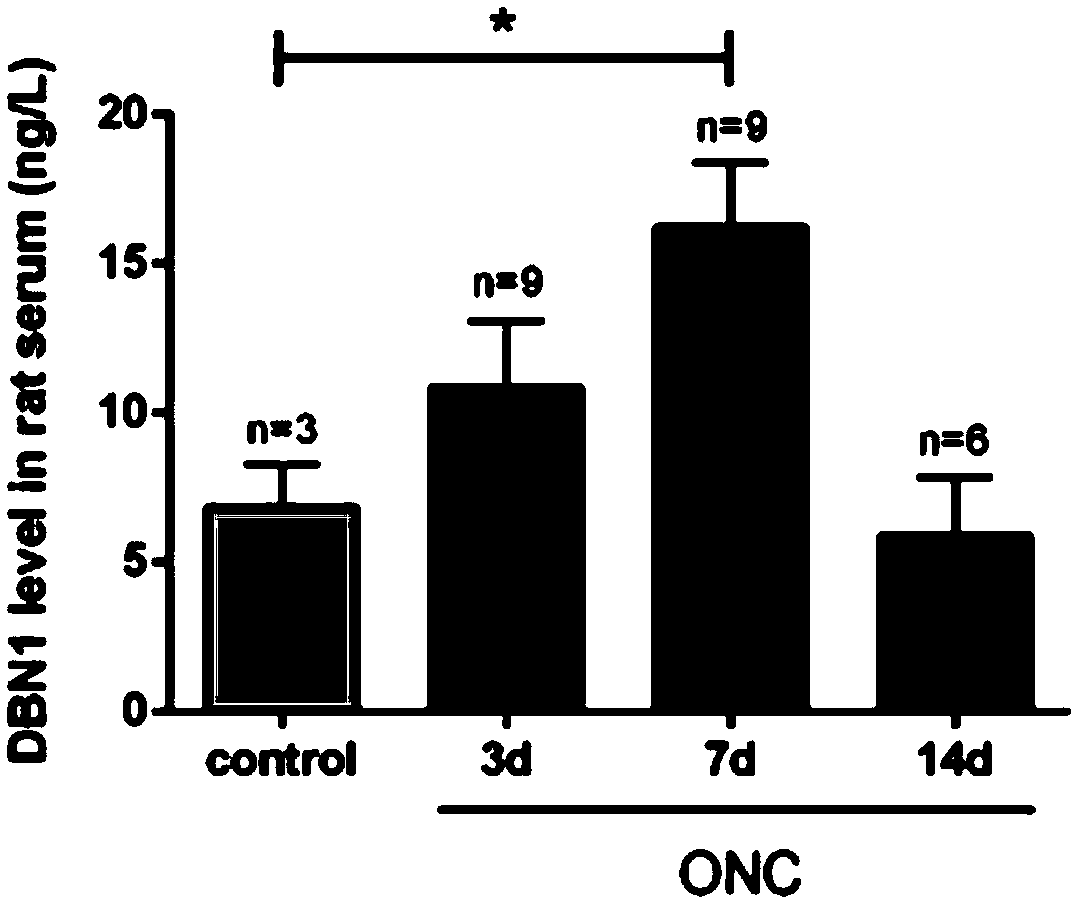 Application of drebrin (DBN1) to preparing neurodegenerative disease diagnosis medicines