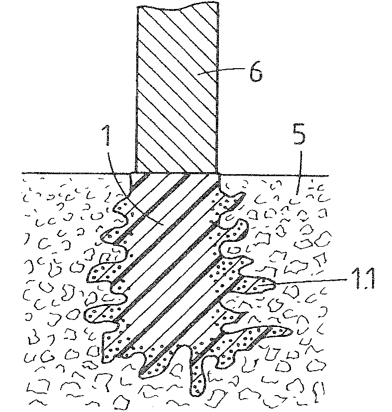 Implant, method of preparing an implant, implantation method, and kit of parts
