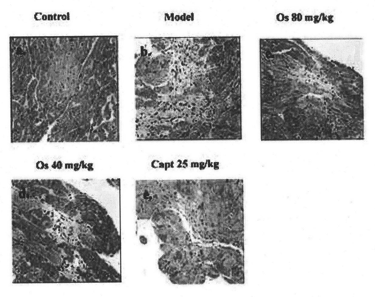 Application of osthole in preparation of medicament for preventing and treating myocardial fibrosis