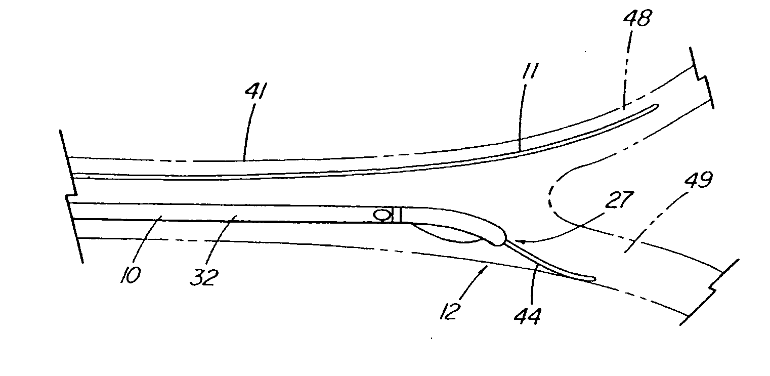 System and method for introducing a prosthesis