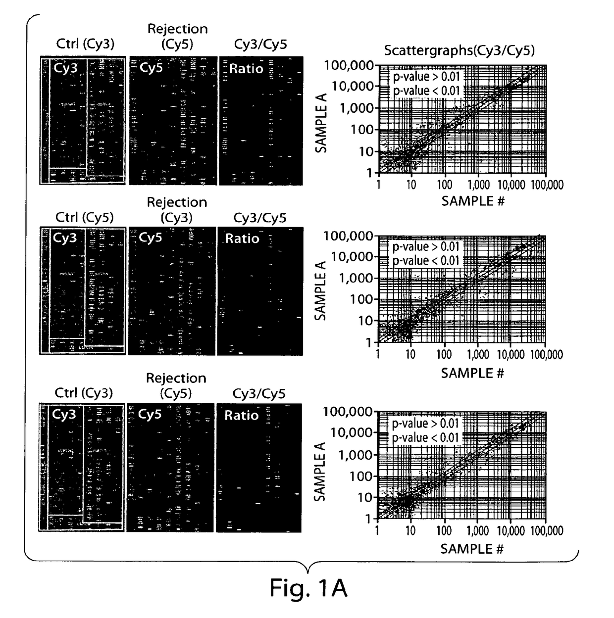 Detection of organ rejection