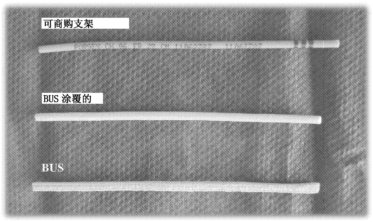 Biodegradable ureteral stents, methods and uses thereof