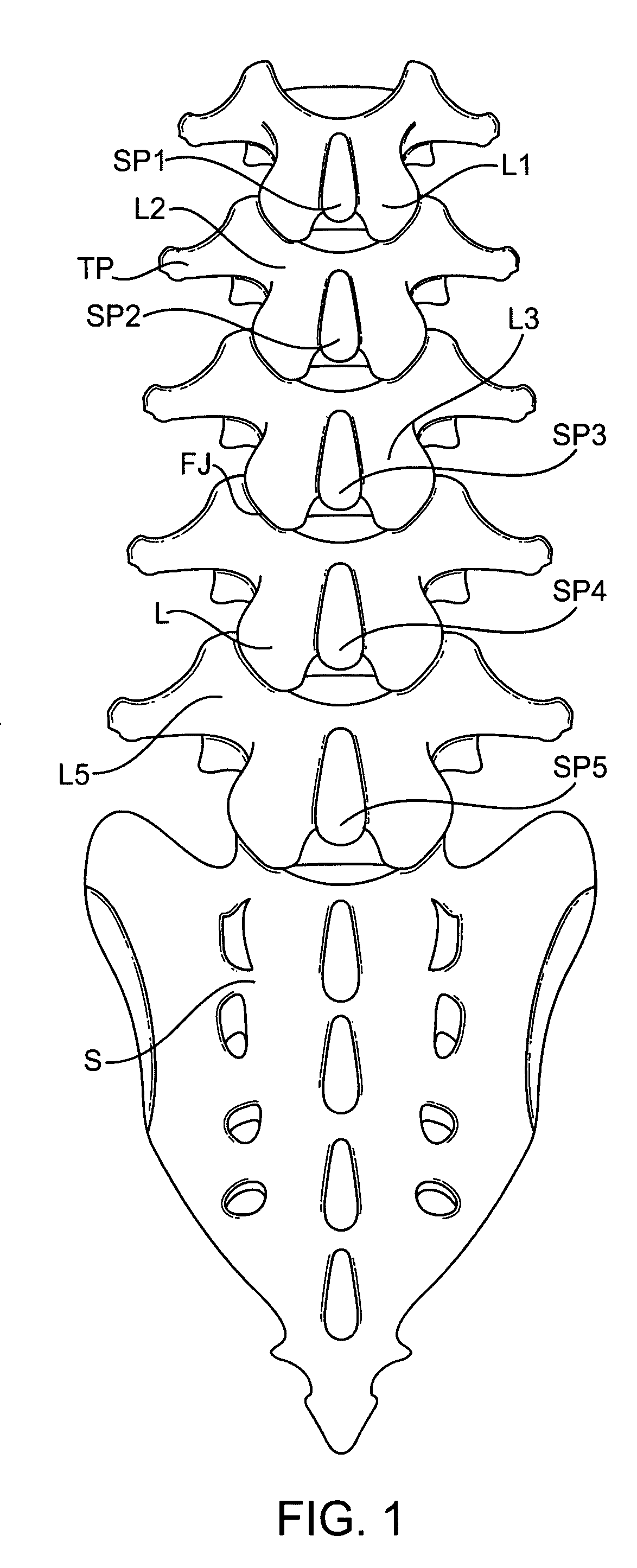 Methods and systems for constraint of spinous processes with attachment