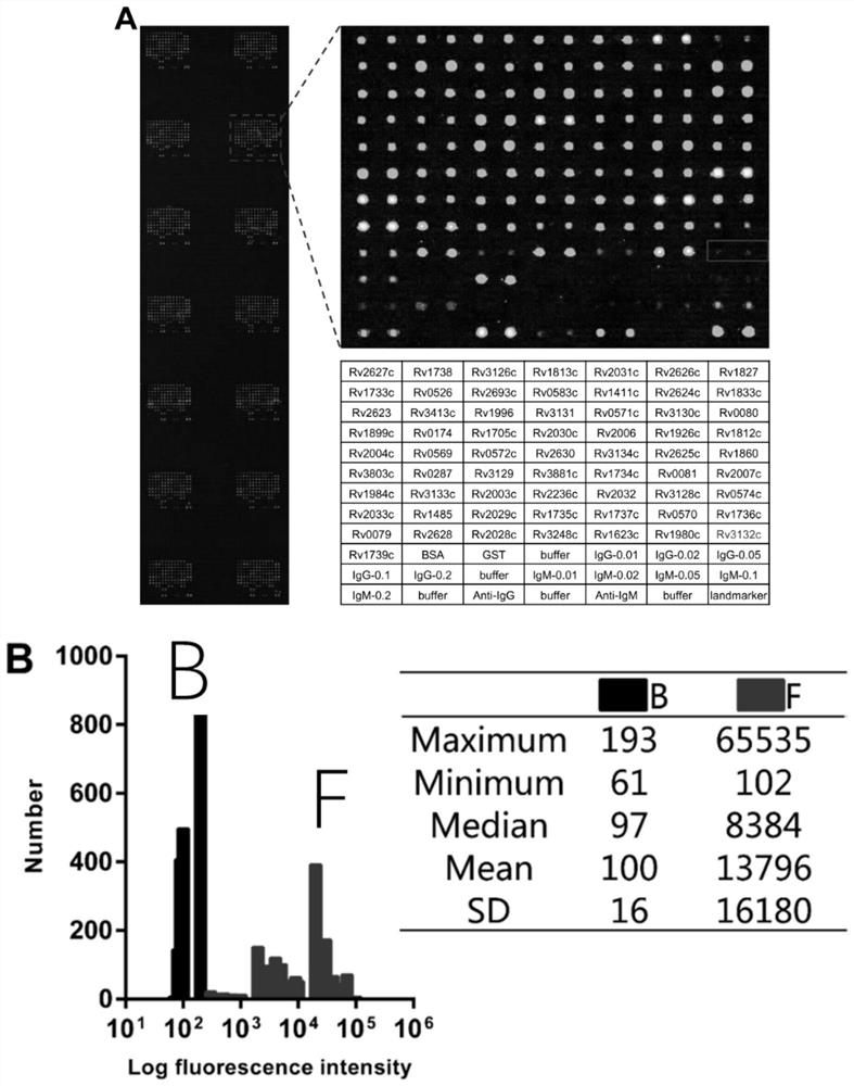 Application of Rv1860 protein, RV3881c protein, Rv2031c protein and Rv3803c protein in diagnosis of active tuberculosis infection