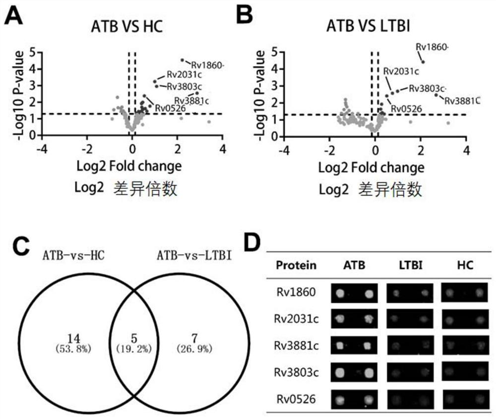 Application of Rv1860 protein, RV3881c protein, Rv2031c protein and Rv3803c protein in diagnosis of active tuberculosis infection