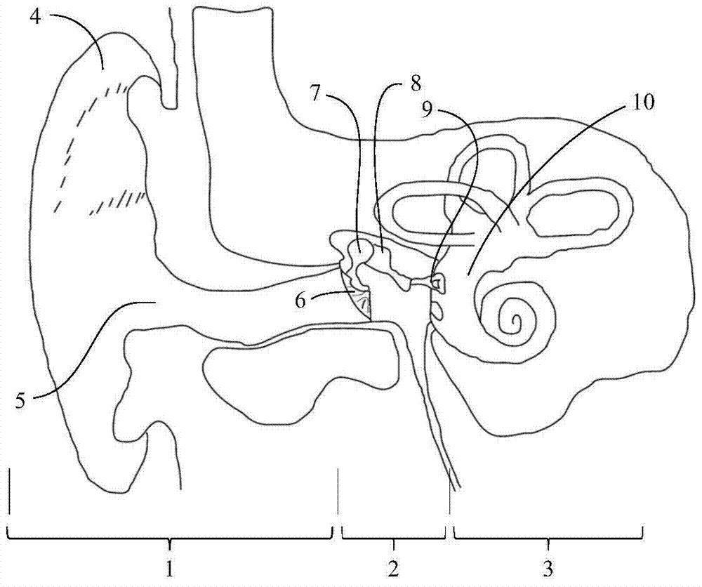 Actuator based on stimulating tympanic membrane and its hearing aid