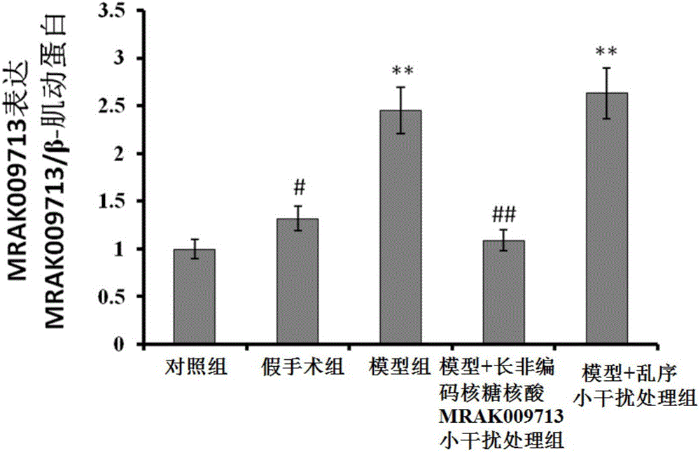 Application of small interfering RNA of long non-coding ribonucleic acid MRAK009713 to preparation of drugs for treating neuropathic pain