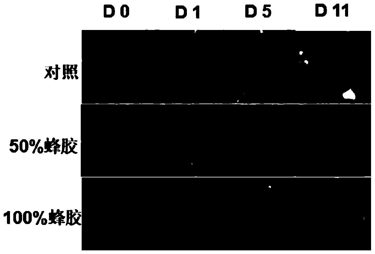 Propolis composition and instrument thereof and application thereof in wound treatment