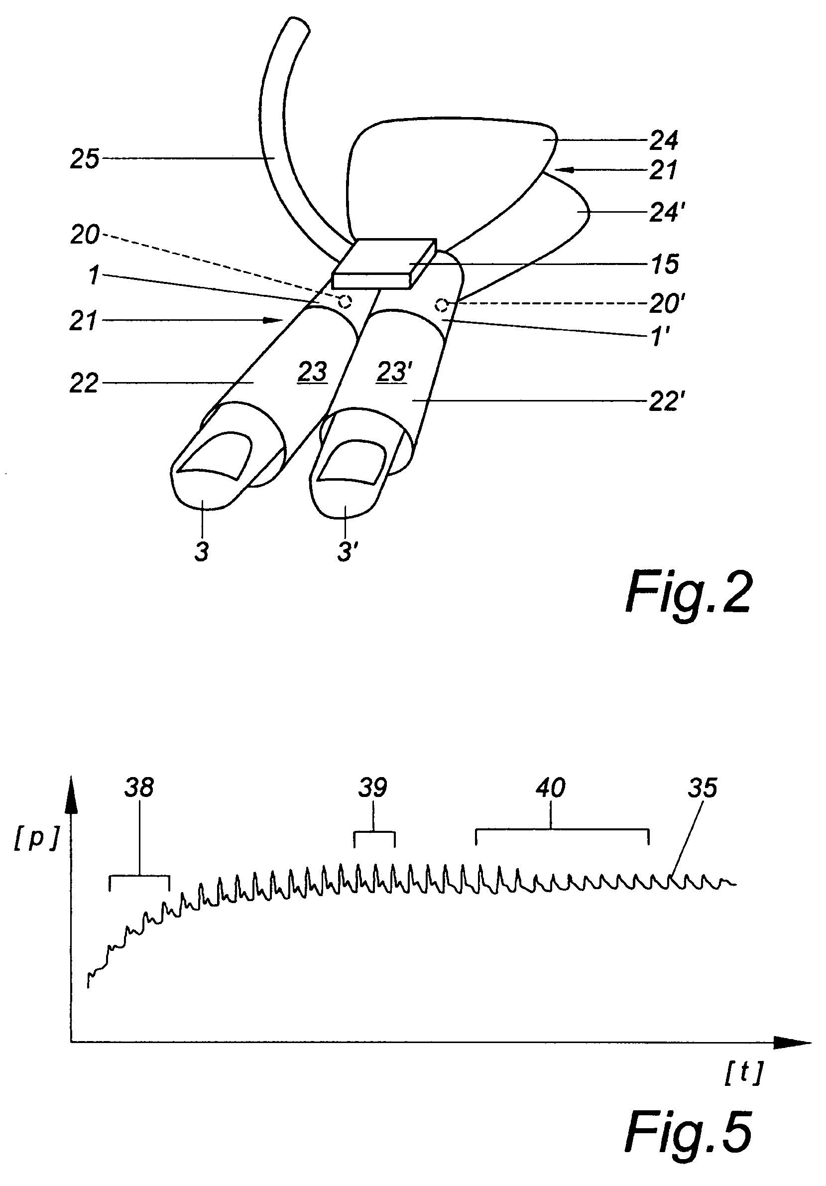 Device and method for the continuous non-invasive measurement of blood pressure