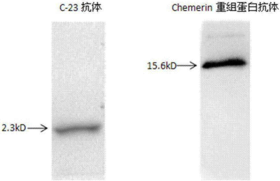 Detection test strip for chemerin and derivative polypeptide thereof and preparation method of detection test strip