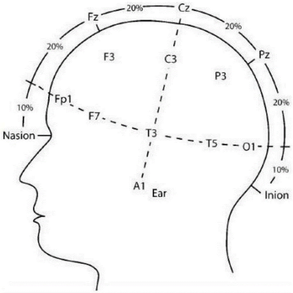 Device and method for positioning EEG (electroencephalogram) or MEG (magnetoencephalogram) electrodes in brain MR (magnetic resonance) image