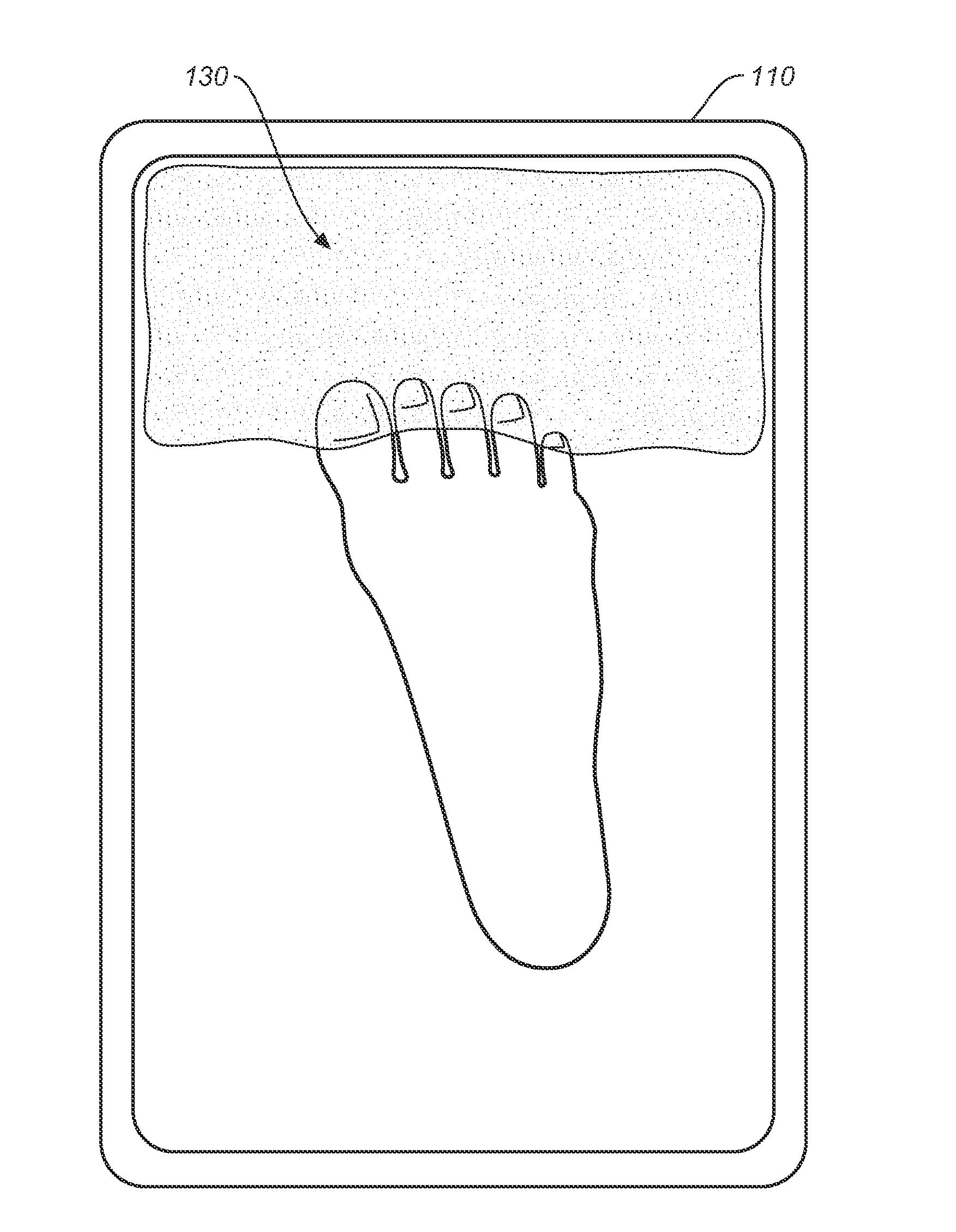 Method and apparatus for improving the appearance of nails affected by onychomycosis through the topical application of an aqueous solution containing boric acid and camphor or other terpenes