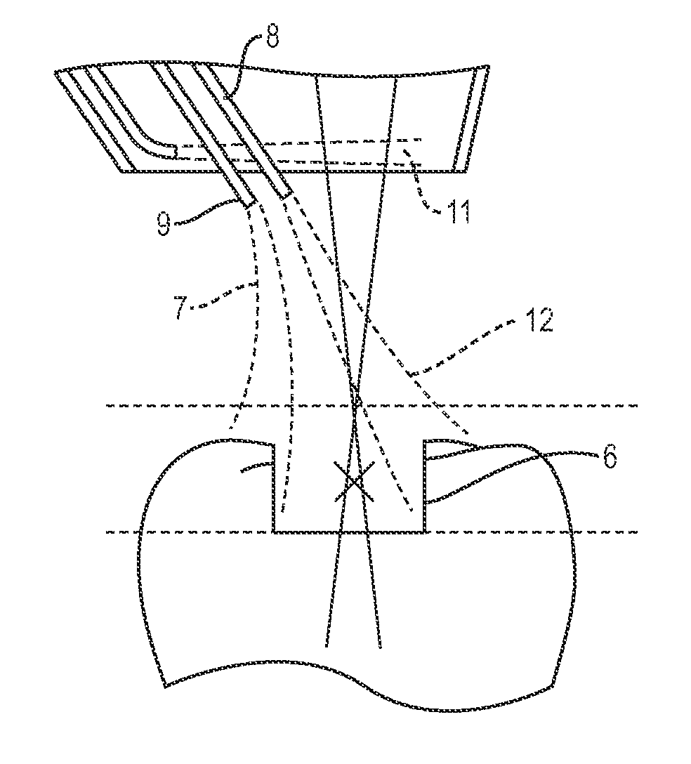 Apparatus and method for controlled fluid cooling during laser based dental treatments