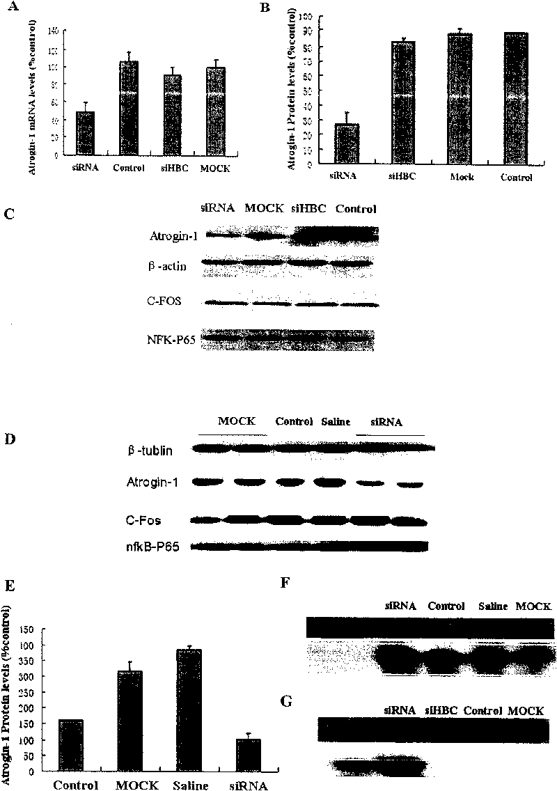 Interference RNA interfering muscle specific E3 ubiquitin protein ligase gene, carrier containing same and application thereof