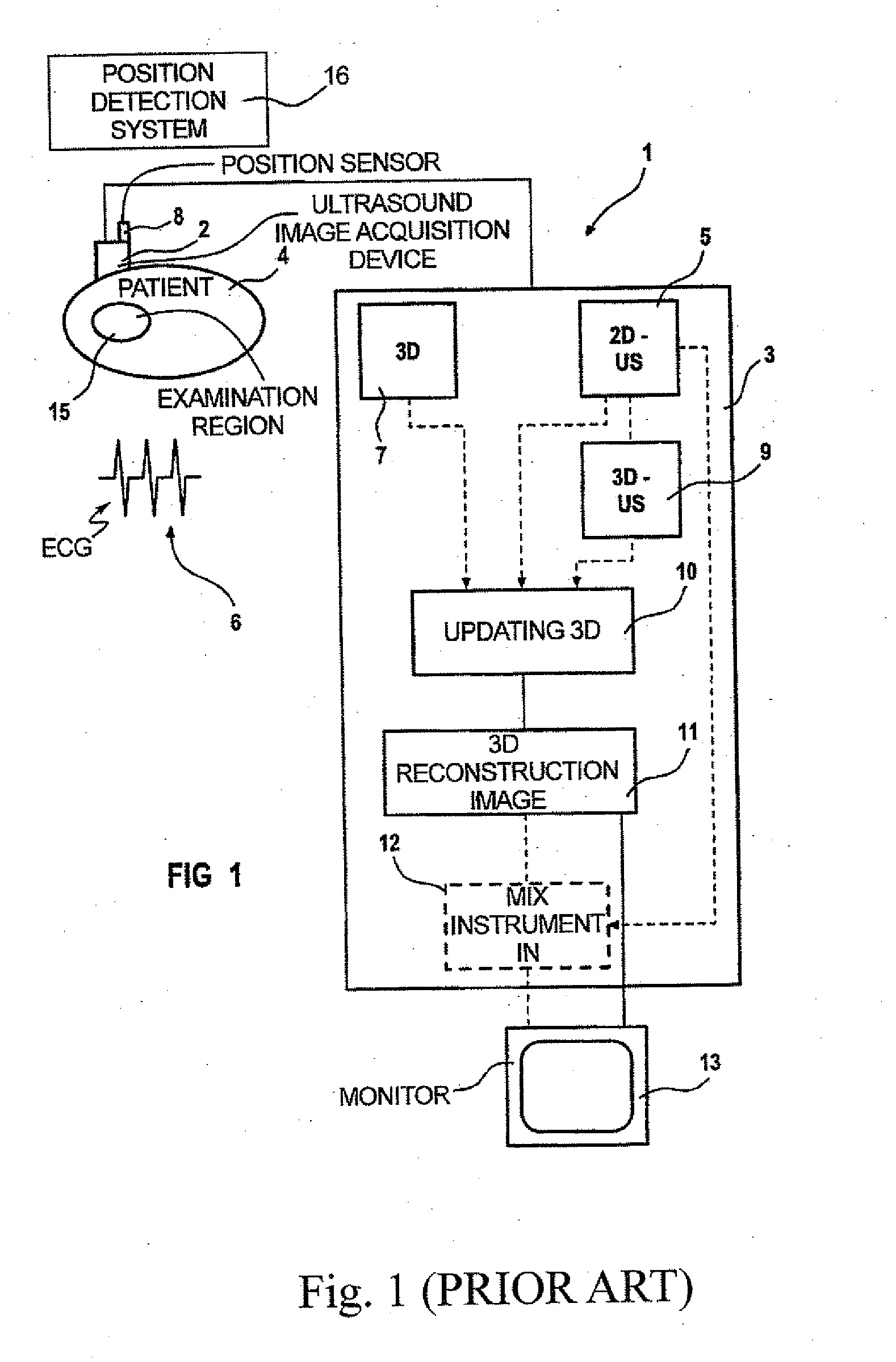 Apparatus and method for providing a dynamic 3D ultrasound image