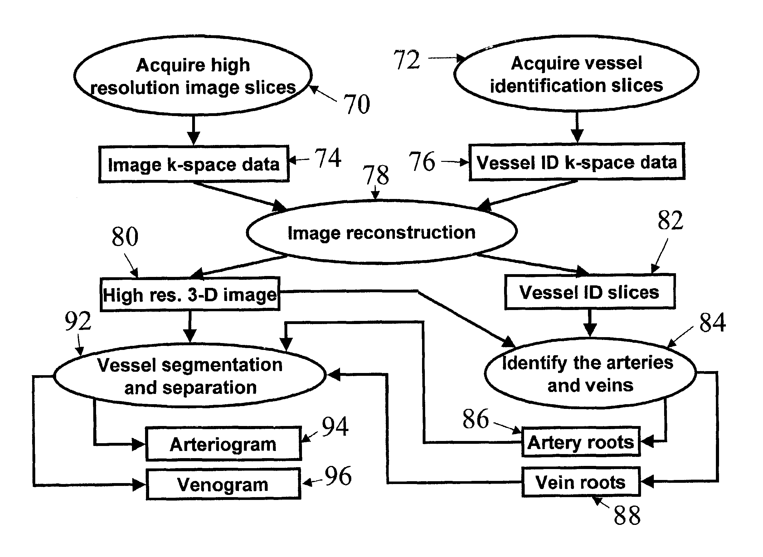Automatic vessel indentification for angiographic screening