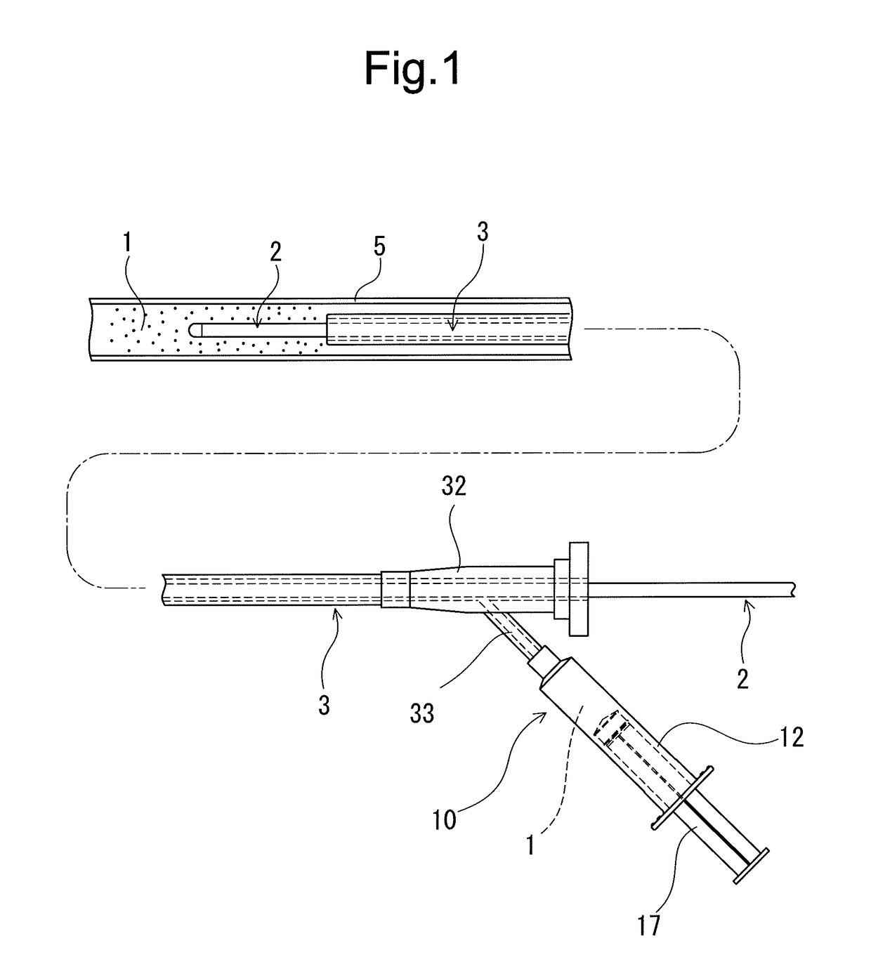 In-vivo intravascular blood replacing liquid, in-vivo intravascular blood replacing liquid formulation, and prefilled syringe