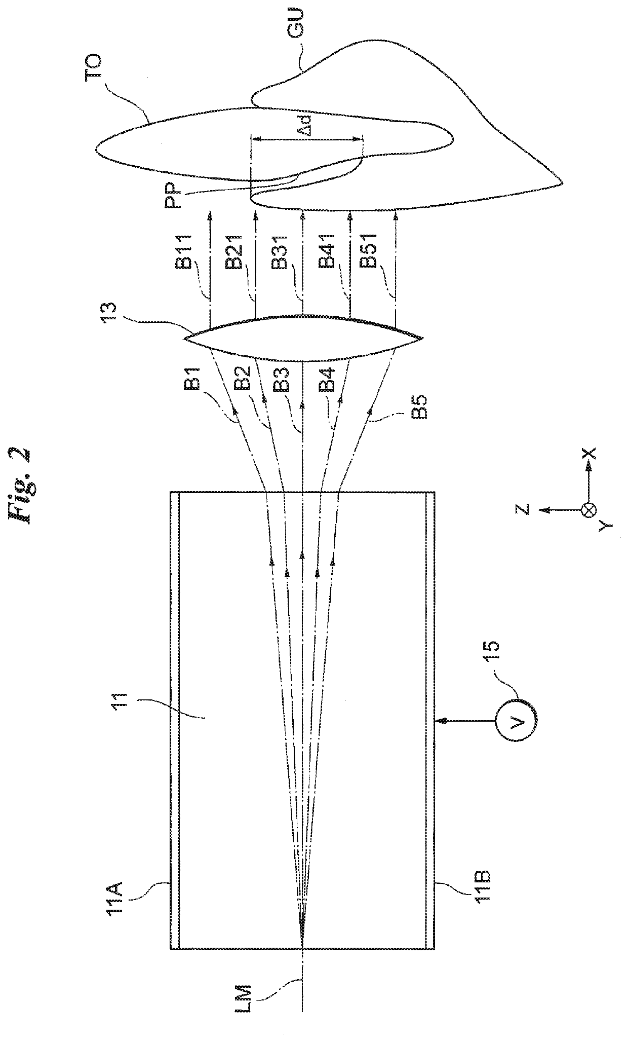 Periodontal pocket examination apparatus