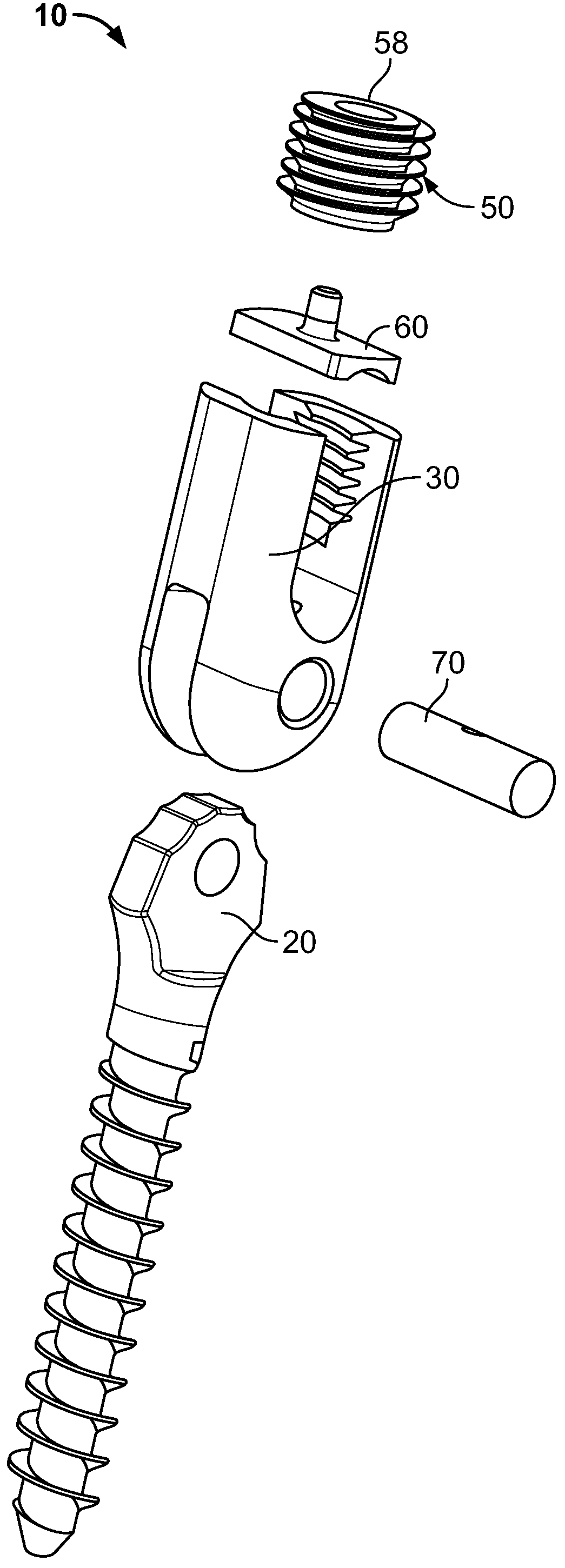 Mono-planar pedicle screw method, system and kit