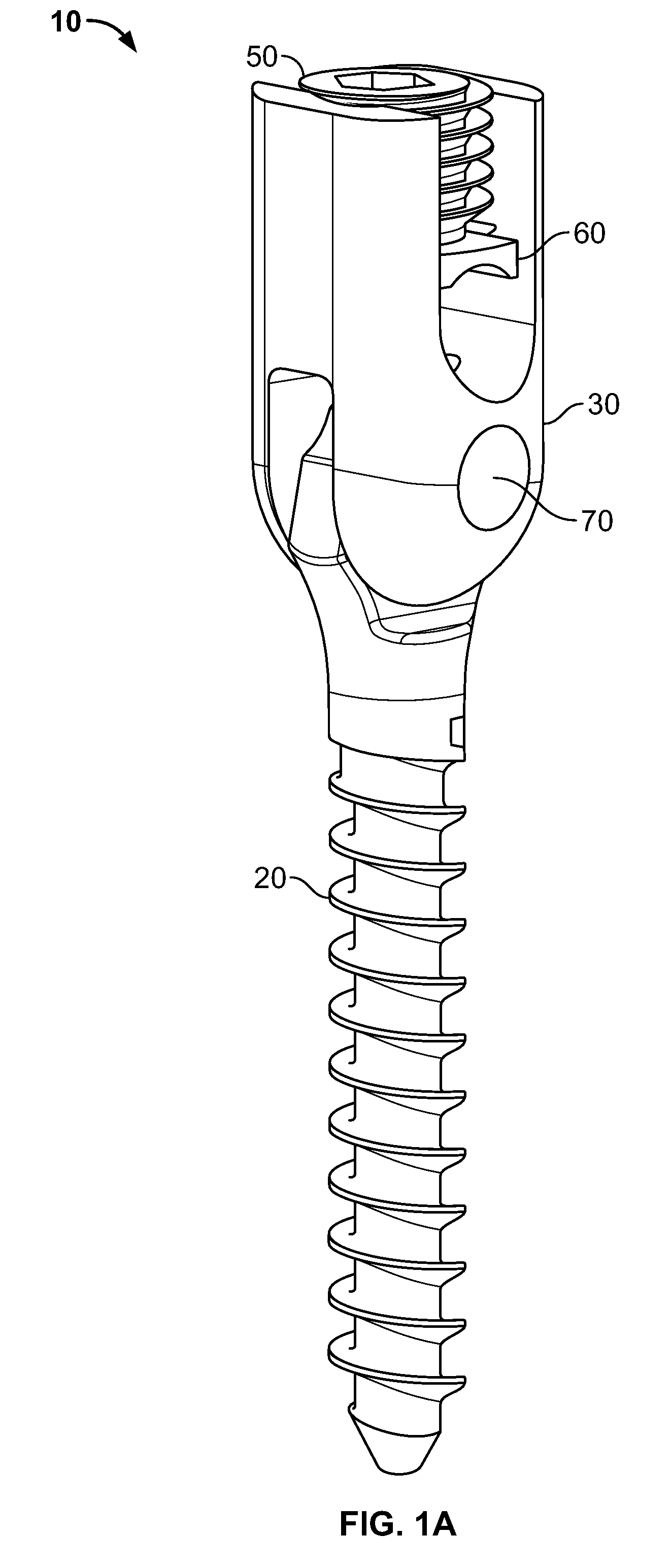 Mono-planar pedicle screw method, system and kit