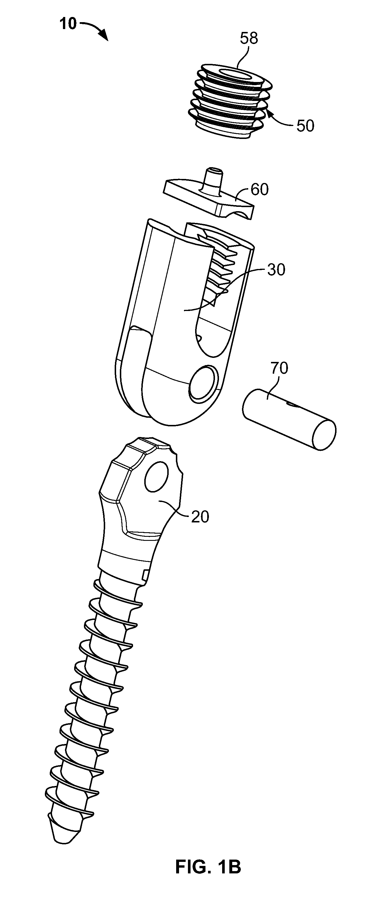 Mono-planar pedicle screw method, system and kit