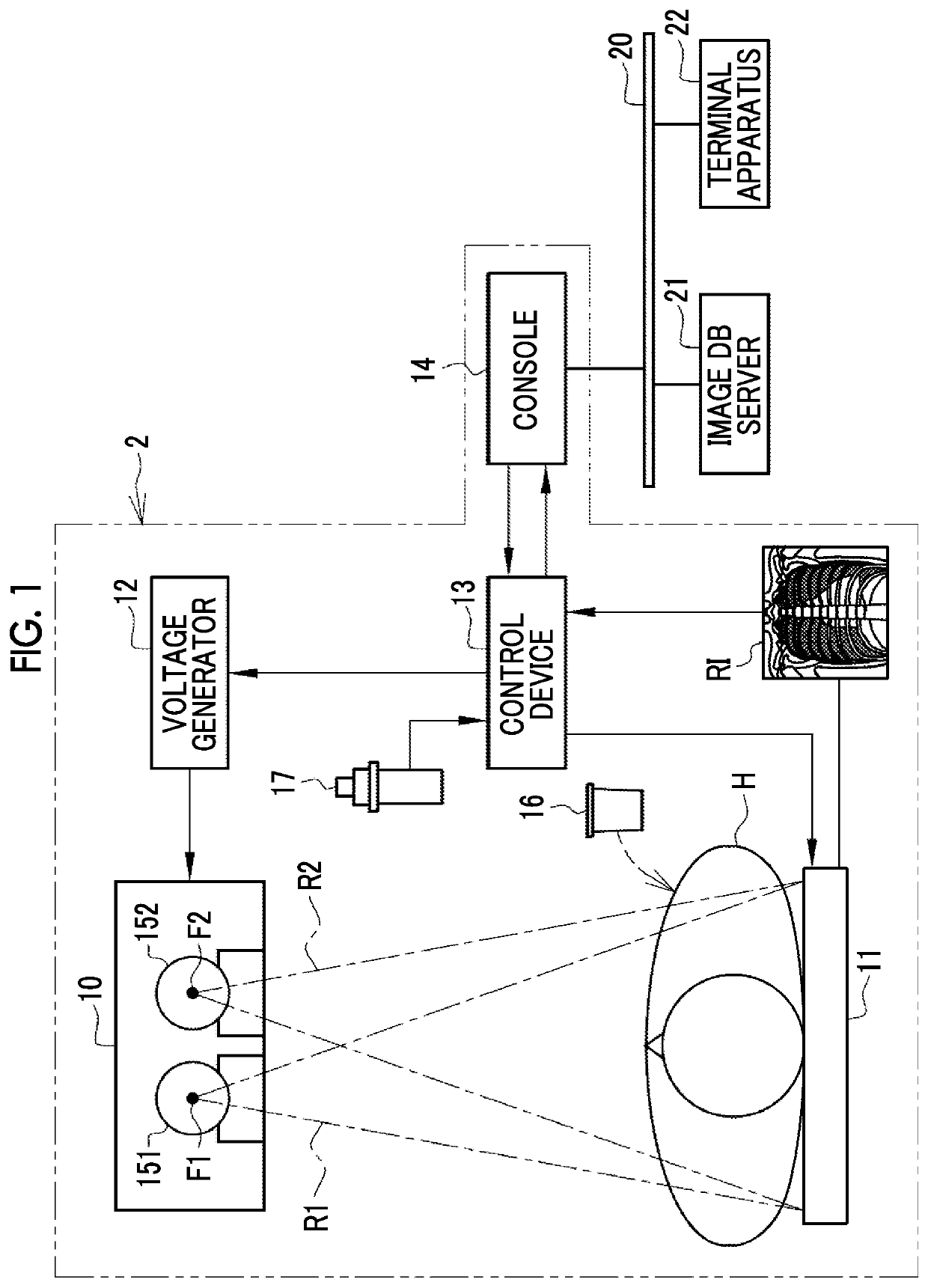 Radiography apparatus, radiography apparatus operation method, and radiography apparatus operation program