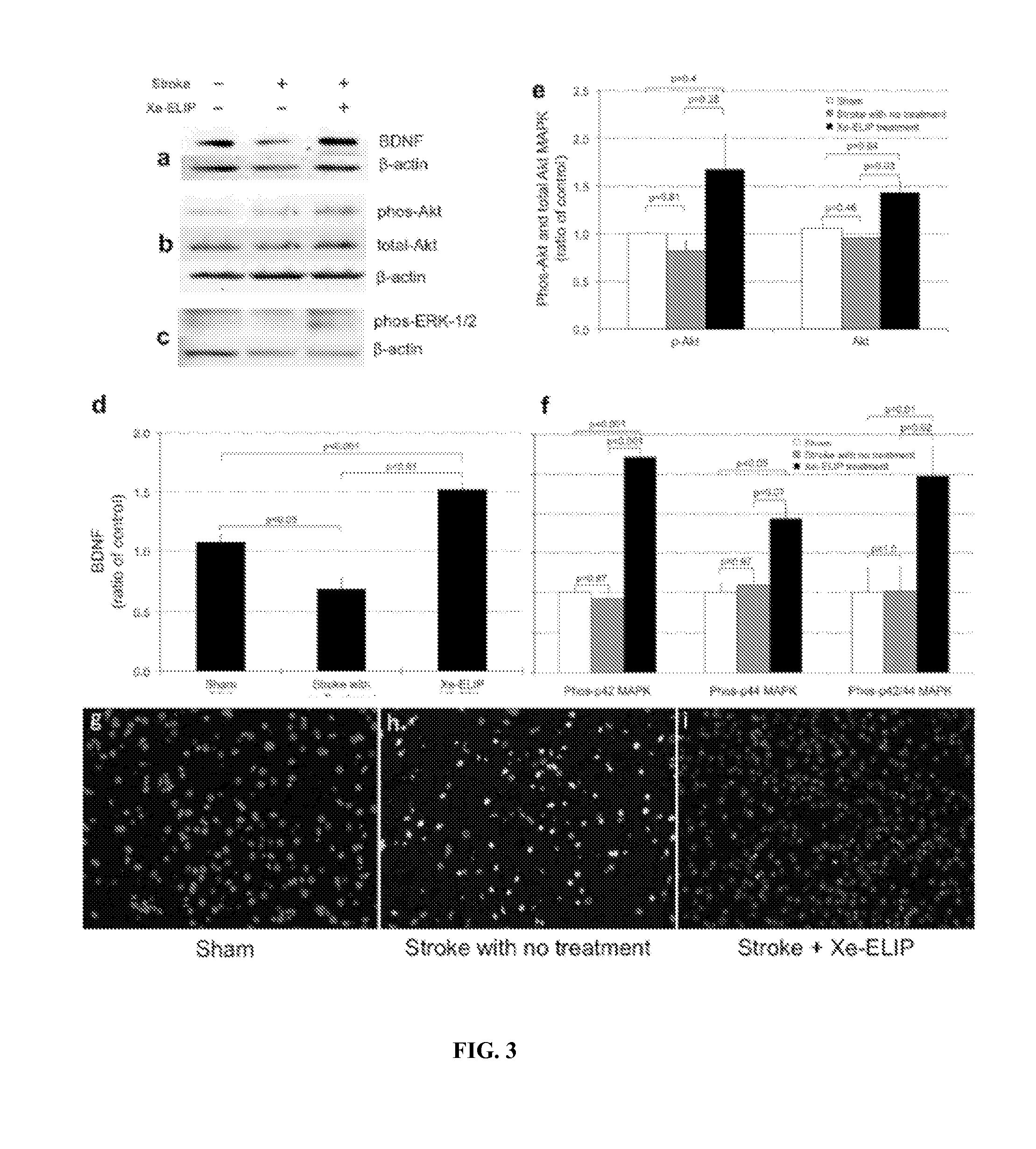 Neuroprotective liposome compositions and methods for treatment of stroke