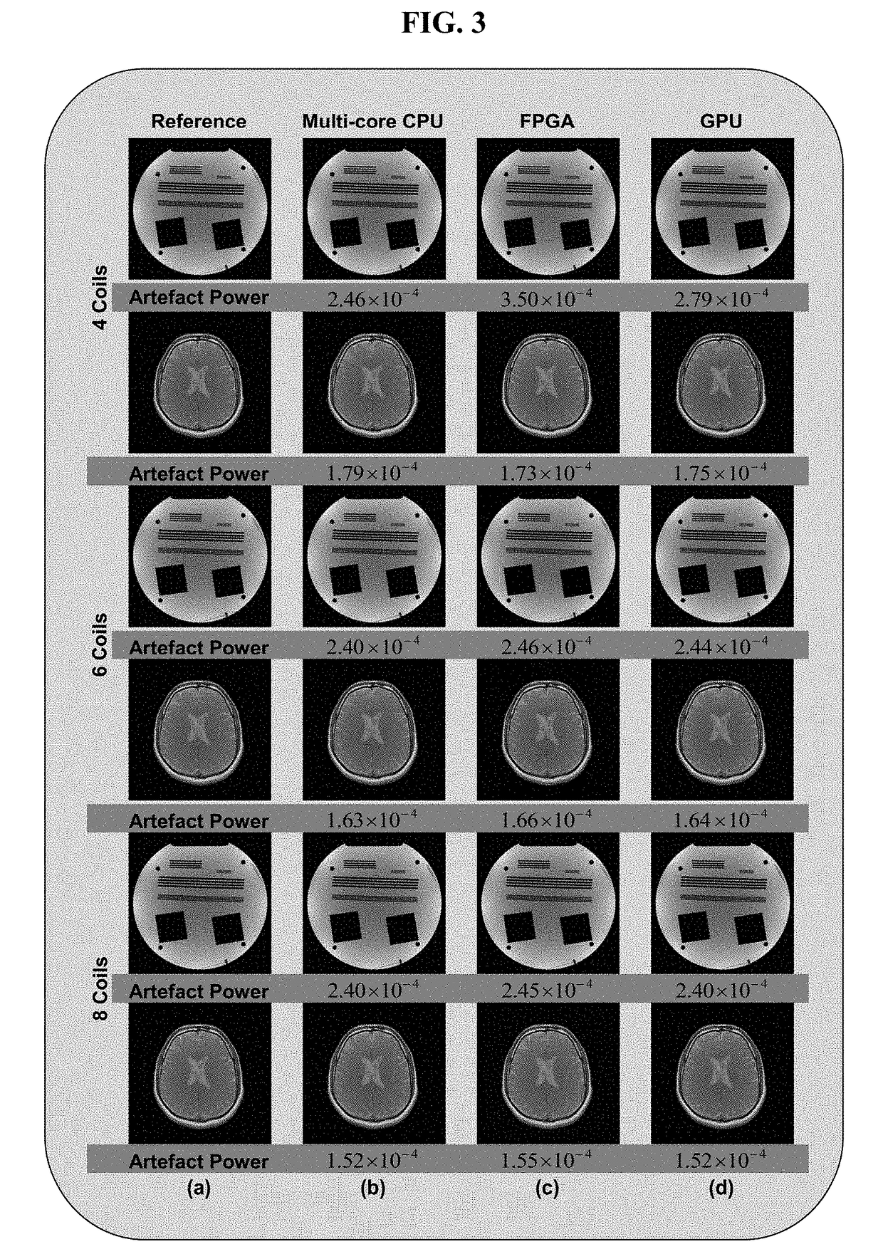 FPGA implementation of a real-time parallel MRI reconstruction