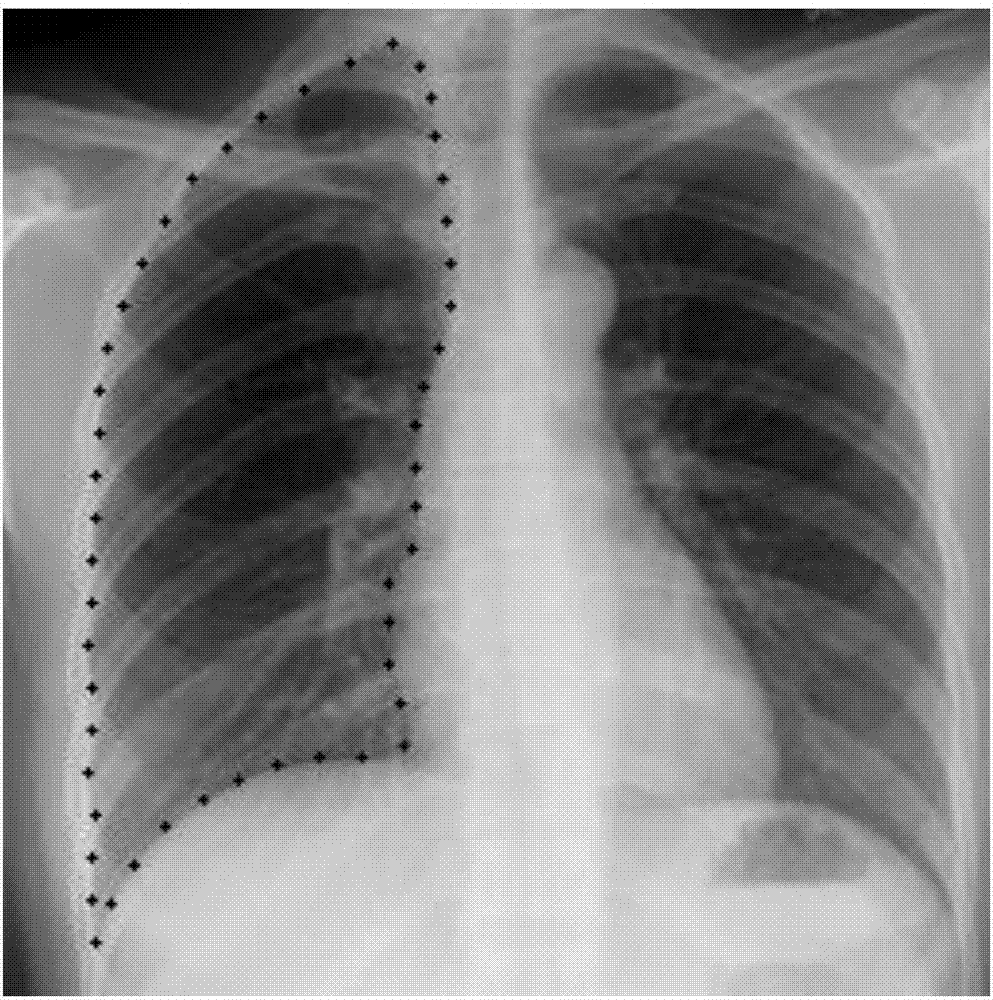 Efficient medical image segmentation method based on game framework