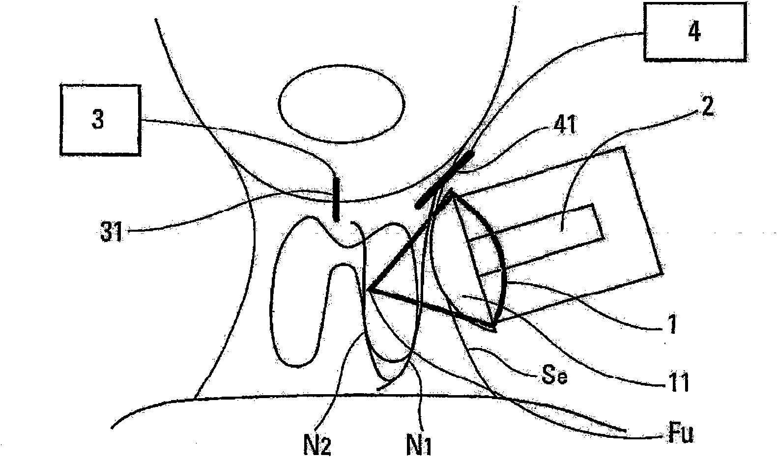 Non-invasive device and method for locating a structure such as a nerve