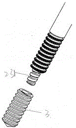 a spinal screw