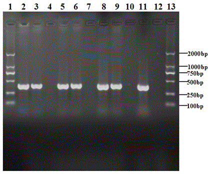 Guava colletotrichum orbiculare specificity PCR detecting primer and detecting method of guava colletotrichum orbiculare