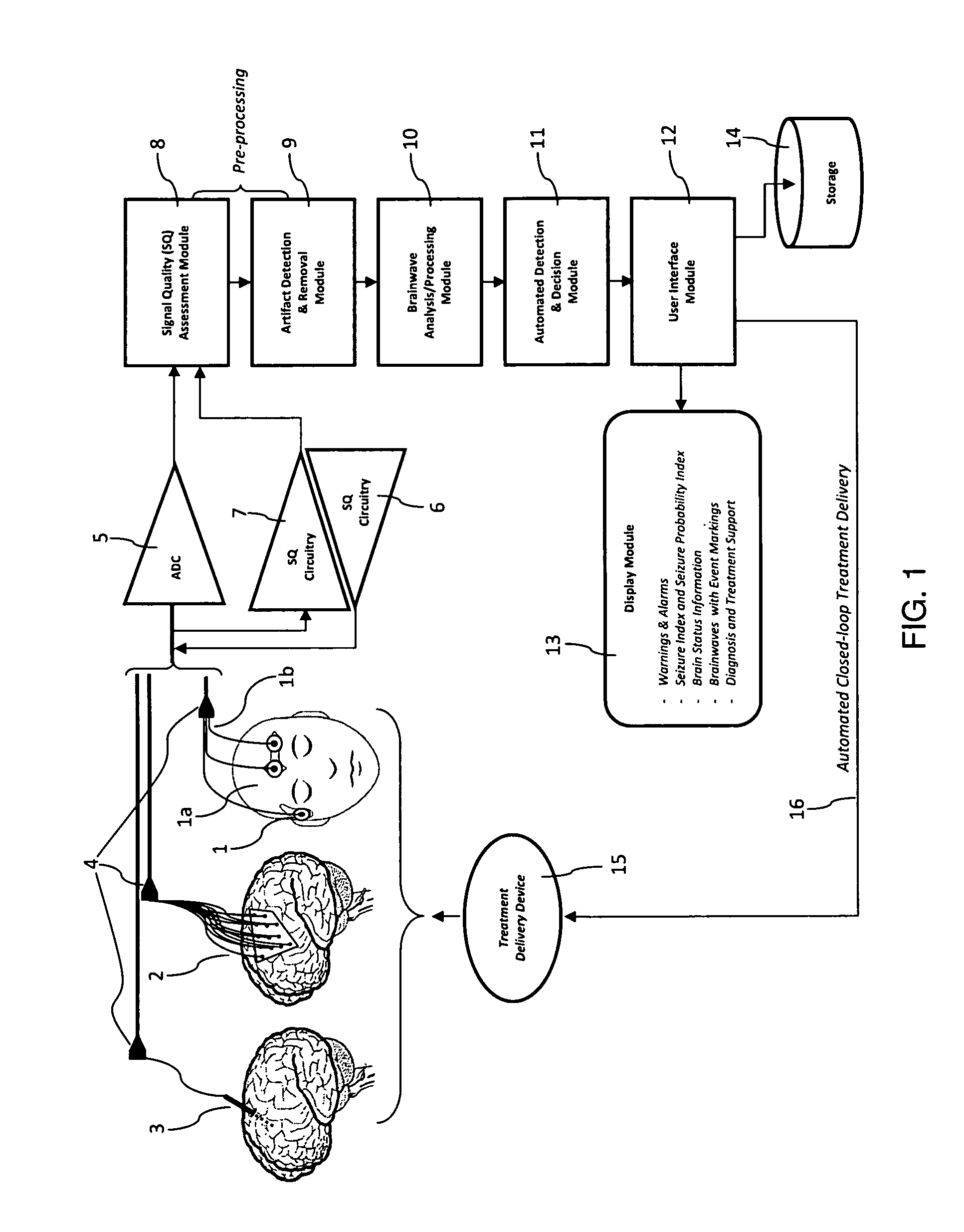 Method for amplifying abnormal pattern signal in observed brain activity of a subject for diagnosis or treatment