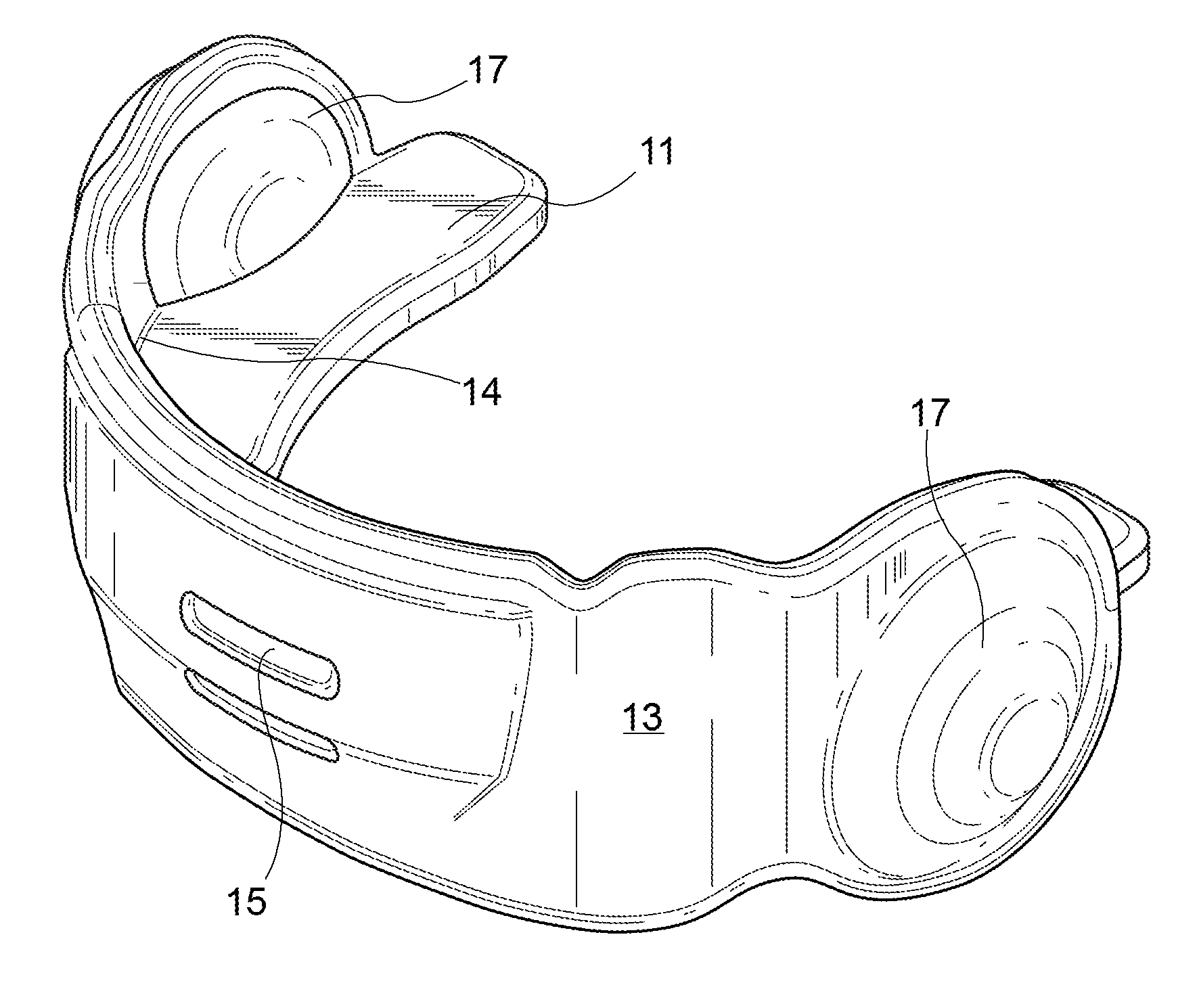 Stabilizer Mouthguard