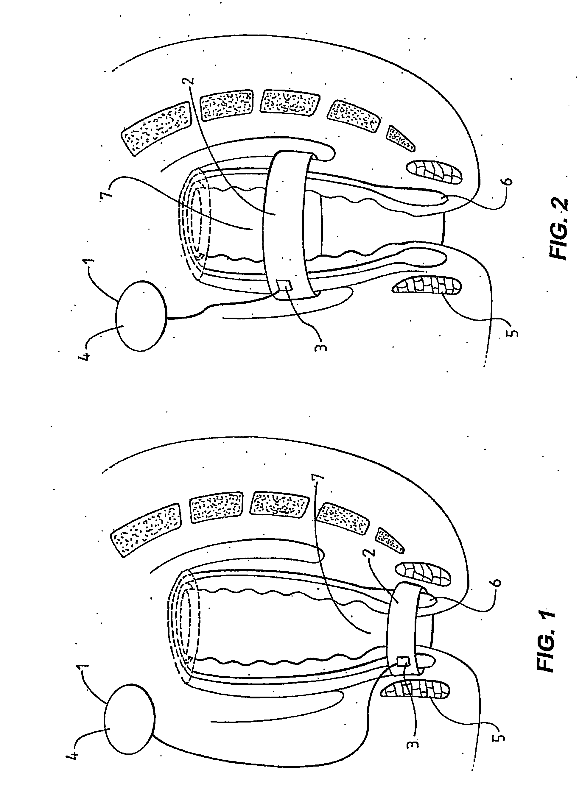Method and Apparatus for Treating Fecal Incontinence