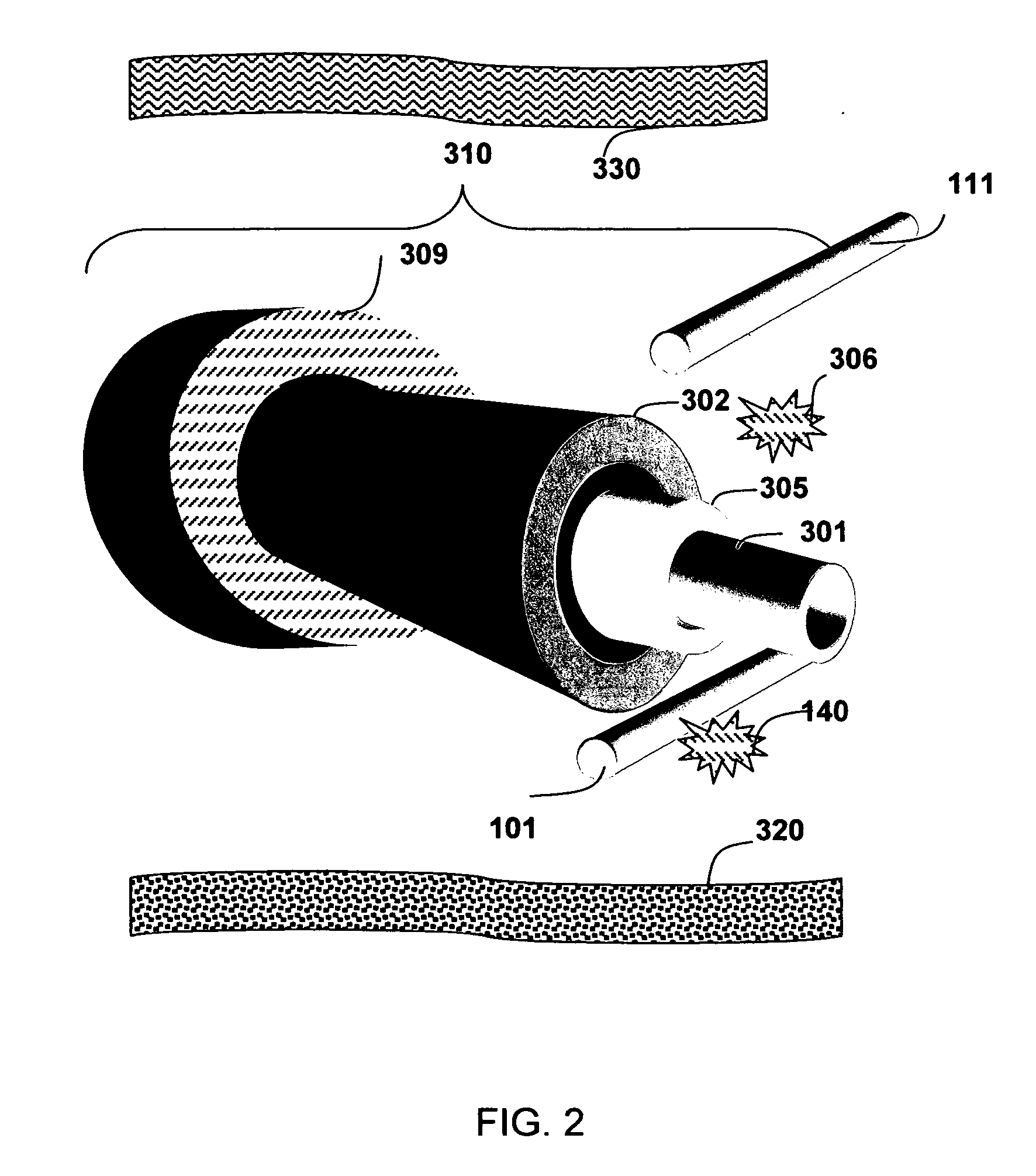 Ablation apparatus and system to limit nerve conduction