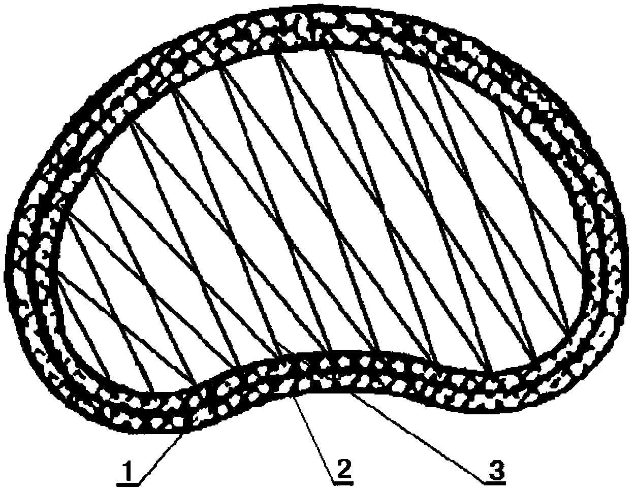 Mesh type mitral valvuloplasty ring