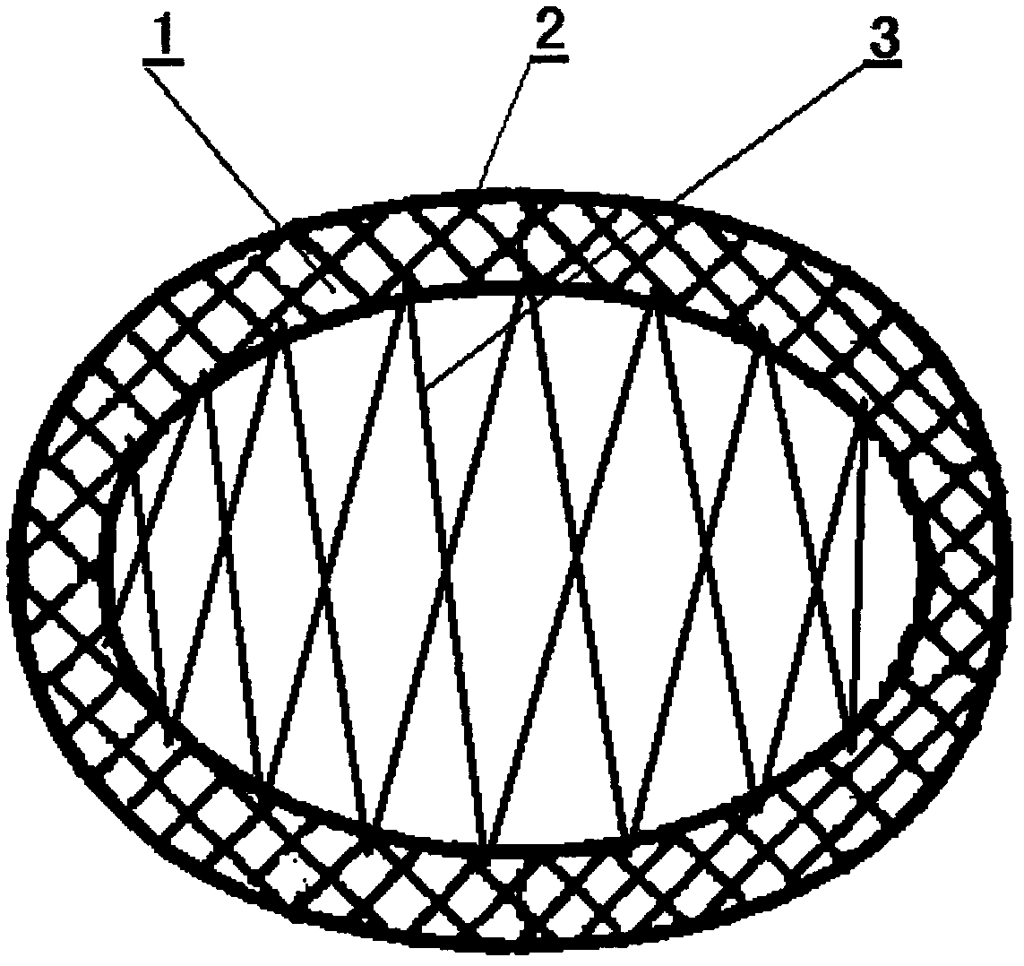 Mesh type mitral valvuloplasty ring